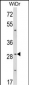 ZFP36 Antibody (Center)